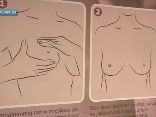 Bezpłatna mammografia