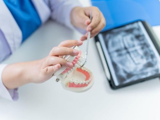 Nowoczesne technologie w implantologii – jak Gdańsk staje się liderem stomatologii cyfrowej